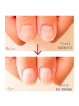 サロン クローバー/美爪育成ネイルケア