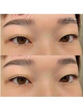 リムル バイ グリッター(RIMURU by GLITTER)/人気のセットメニュー