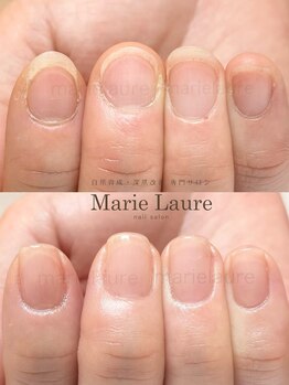 マリーロール 淀屋橋本店(Marie Laure)/自爪育成/深爪矯正/ネイルケア