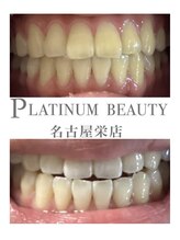 プラチナムビューティー 名古屋栄本店(PLATINUM BEAUTY)/お客様Before After