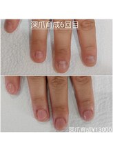 ピピ(PiPi)/深爪育成＋カラージェル♪