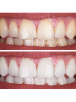 ミラ 中央林間(mira)/小顔　毛穴　ホワイトニング