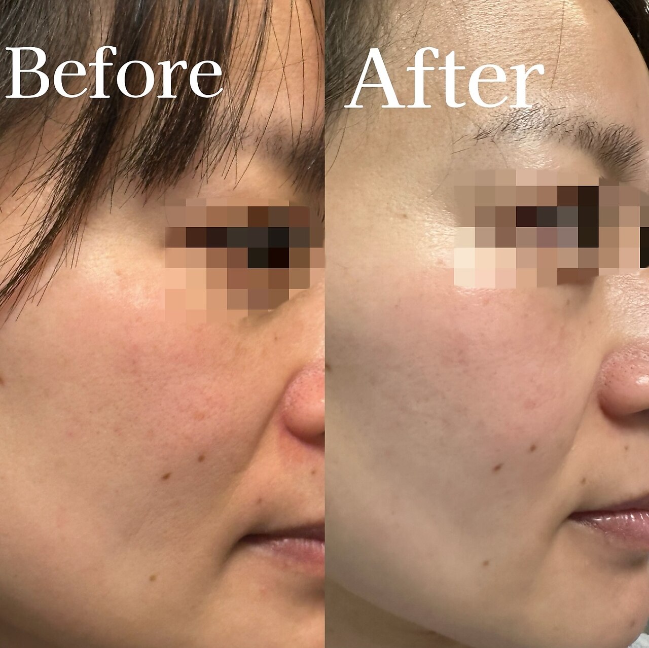 ビューティーワン 赤羽店(Beautyone)｜ホットペッパービューティー