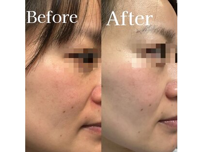 ビューティーワン 赤羽店(Beautyone)の写真