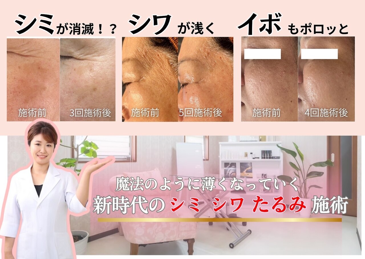 簡単ダイエット無刺激★高周波温熱美肌献身美容器★ビューティワールドお求めの方にも ビューティーワンド ココ(Beauty Wand COCO)｜ホットペッパービューティー