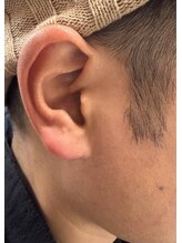 ウィード美容 健康スタジオ(WEAD美容 健康STUDIO)/背中のこわばりに。耳で全身調整