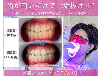 ネージュ(neige)の写真