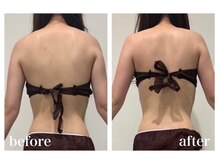 ファビリス 仙台ロフト店(FAVILIS)/【痩身】キャビリポ痩身60分2回