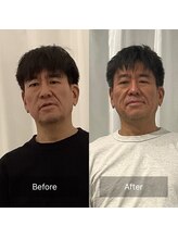 美容整体プラスフィール 恵比寿本店/小顔・姿勢改善