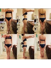 アンリール 旭川店(Anrire)/BODY施術のお客様です！