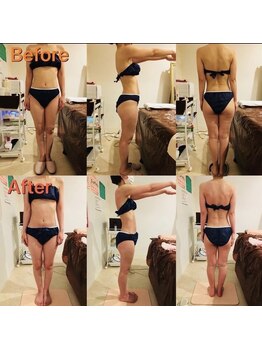 アンリール 旭川店(Anrire)/BODY施術のお客様です!