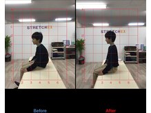 ストレチックス 近江八幡店/BeforeAfter