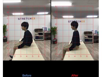 ストレチックス 近江八幡店/BeforeAfter