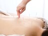 【肩こり・腰痛を解消する全身鍼灸】身体と心のリセット60分/担当:島辺