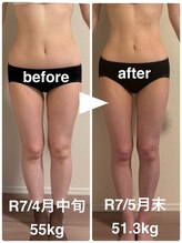 ハッチー(Hacchi)/【20代】すらっと美脚痩身！