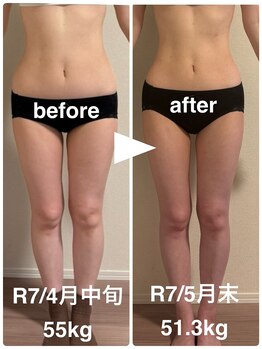 ハッチー(Hacchi)/【20代】すらっと美脚痩身！