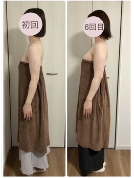 ロココ 国立店(Rococo)/☆巻き肩改善と共にバストアップ