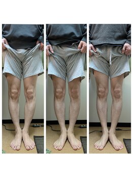 レディア 伊勢店(Re:Dear)/O脚矯正