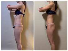 一軒家サロン つぼみの雰囲気（完全個室でリラックスいただけます。大人女子に人気♪）