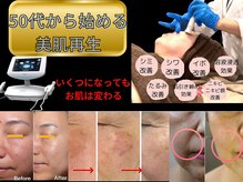 じぶんniプラス