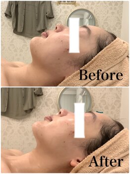 スペチアーレ 夙川/リフトアップ効果抜群