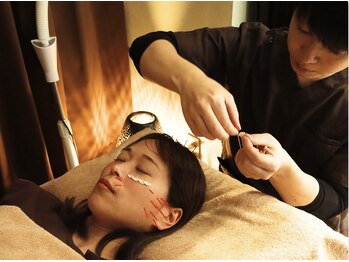 ホグ レール 東林間の写真/小顔になりたいあなたへ！地域最安値の結果が出る美容鍼でフェイスラインを整え、自信あふれる表情に☆