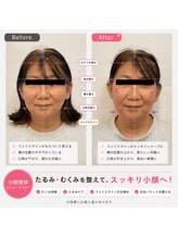 ふみらぼ 亀有/5歳若見え小顔へ