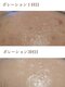 サロンドジョリーの写真/【くすみ・たるみ改善◎ニキビにアプローチ】幹細胞培養液高配合の施術で細胞のチカラを高めて最強肌