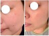 プラペンデュアルを知っていただきたい。 通常33000→11000