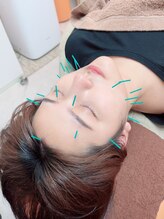 ヒーリングサロン アージュ(A-je)/★美顔鍼＋小顔矯正★