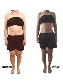 アロマテラピー 古香/話題のボディマシンでスッキリ