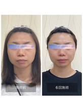 ハリ トモカ 南浦和サロン(HARI TOMOKA)/美容鍼