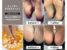 アネモネ(Anemone)の雰囲気（秋冬おすすめ！ひび割れる前に！ガサガサかかとにさようなら♪）