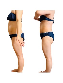 ソフィアアイズ 倉敷店(SOPHIAEYES)/ハイパーナイフ７での効果