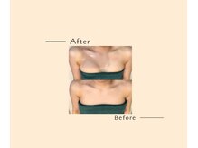 オベリオ(OBERIO)/