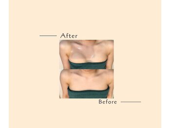 オベリオ(OBERIO)/