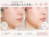 【人気No.2】夏のメイク崩れを激減♪美白肌脱毛（フルフェイス）¥11000→