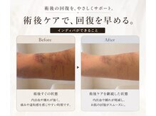 ミュア 難波大国町(Myua)の雰囲気（インディバで術後回復、お悩みをサポート致します。）