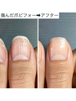 桃の木 吉祥寺店/酸素透過性で爪に優しいコート材