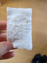 ラーナ(Lana)/毛穴洗浄