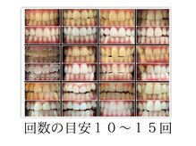 ホワイト アザブ(White Azabu)