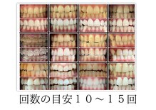 ホワイト アザブ(White Azabu)