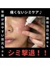 効果実感★シミにWアッタク【シミケア20分＆高濃度美容液導入】 ¥17400→9200