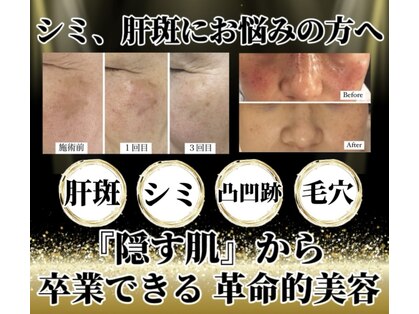 レーヌ(Reine)の写真