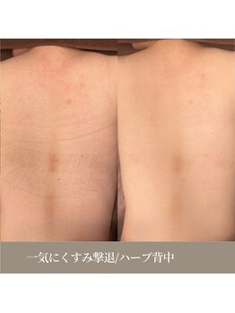 天使の艶肌 武蔵小杉店/ブライダルにも!