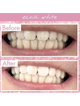 エクシアホワイト 長野店/