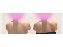 クリスタルプュリティ(Crystal Purity)の雰囲気(背中美人。クリスタルドレナージュ)