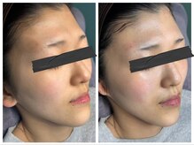 ミミロンビューティー(Mimiron Beauty)の雰囲気（井尻初！韓国No.1艶肌育成【LHAララピール】正規取扱店）