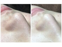 アリュール フェイスアンドボディ(allure Face&Body)