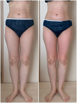 リノ(Lino)/下半身ケア